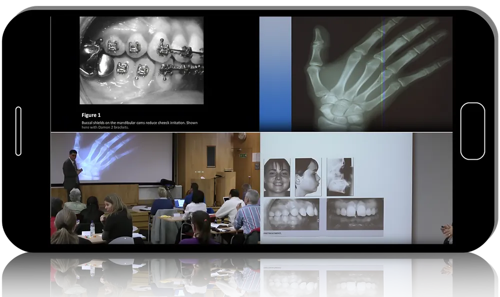 Course image showing orthodontic clinical examples